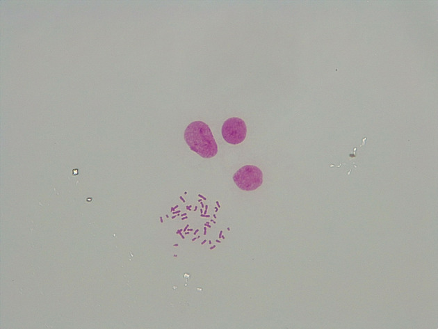Male Chromosomes Slides - Male Chromosomes 09 400X